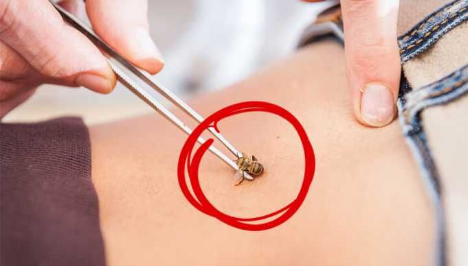 Health Benefits Of Bee Sting Therapy