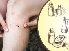 Heal Your Skin Naturally With This DIY Antifungal Cream