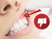 Chances Are…Your Chewing Gum is Loaded with GMO Bacteria and is Rotting Your Teeth