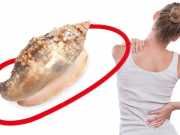 Sea Snail Venom And 7 Other Bizarre Natural Painkillers