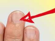 What Your Fingernail Lines Say About Your Health