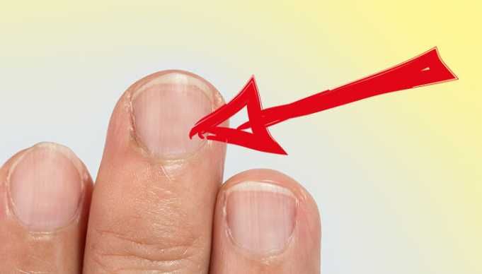 What Your Fingernail Lines Say About Your Health