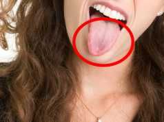 Does Your Tongue Have These? Here’s Why