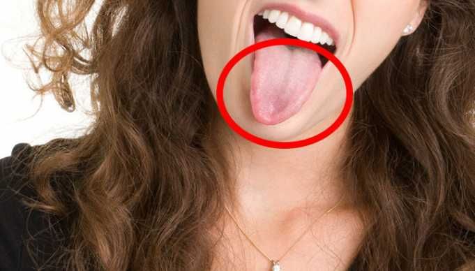 Does Your Tongue Have These? Here’s Why