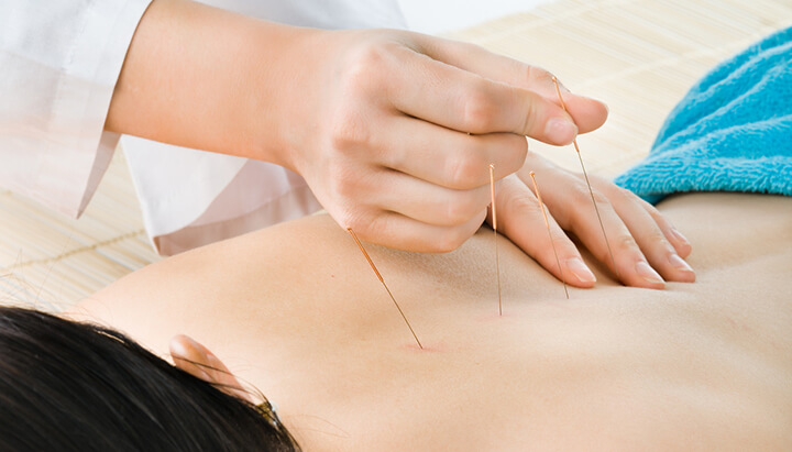 Acupuncture may help you quit smoking, reduce anxiety and get some sleep.