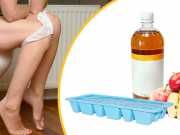 Apple Cider Vinegar Ice Cubes For Hemorrhoids