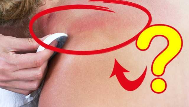 Try Gua Sha Scraping To Fight Facial Puffiness And More