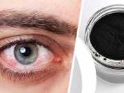 How To Use Activated Charcoal For Pink Eye