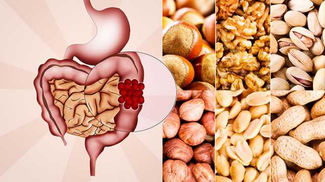 Nuts and colon cancer