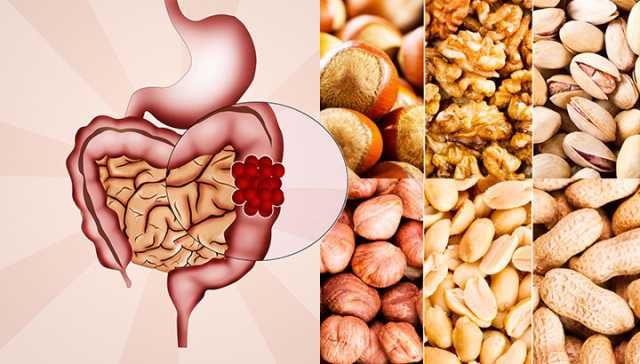 Scientists Say This Food May Help Colon Cancer