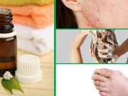 5 Must-Know Benefits Of Tea Tree Oil (And How To Use It)