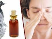 How To Use Emu Oil For Allergies, Digestion And More