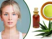 5 Natural Remedies To Treat Rosacea
