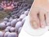 32 Signs Fungus Might Be Taking Over Your Body