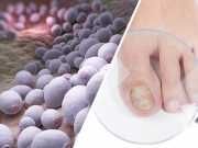 32 Signs Fungus Might Be Taking Over Your Body