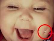 Picture Of Baby With Pierced Dimple Sparks Outrage