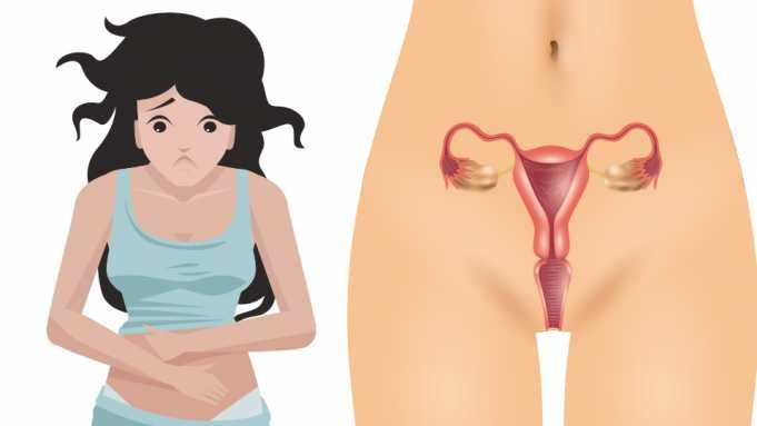 4 Secret Signs Of Ovarian Cancer (Check Urine Now)