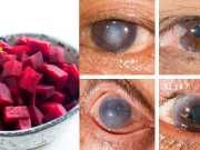 Juice These 3 Superfoods To Detoxify Your Liver And Improve Vision