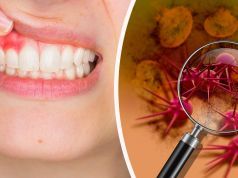 Here’s How To Know If You Have Inflammation In Your Mouth