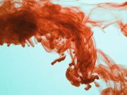 Bizarre Disorder Causes This Woman To Sweat Blood