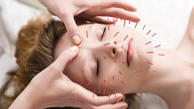 Can acupuncture mend a broken heart