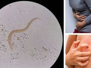 7 Strange Signs You Have A Parasite Living Inside Of You Right Now
