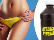 Why I Put Hydrogen Peroxide On My Vagina