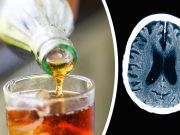 New Study: THIS Is What Happens To Your Brain On Sugar