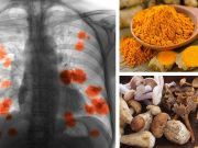 These 5 Foods Can Help You Stop The Spread Of Lung Cancer