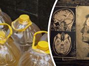 Canola Oil Might Be Bad For Your Memory, Study Finds