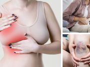 Do You Know The 20 Deadly Cancer Signs? (#19 Will Shock You)