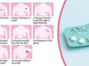 If You’re On This Birth Control, It Could Increase Your Risk Of Breast Cancer