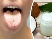 I Used These 4 Tricks To Cure Candida In A Week