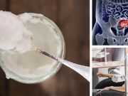 3 Amazing Benefits Of Coconut Oil For Cancer Patients