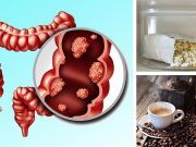 4 Foods That Increase Your Risk Of Colon Cancer (And 3 Foods That Fight It)