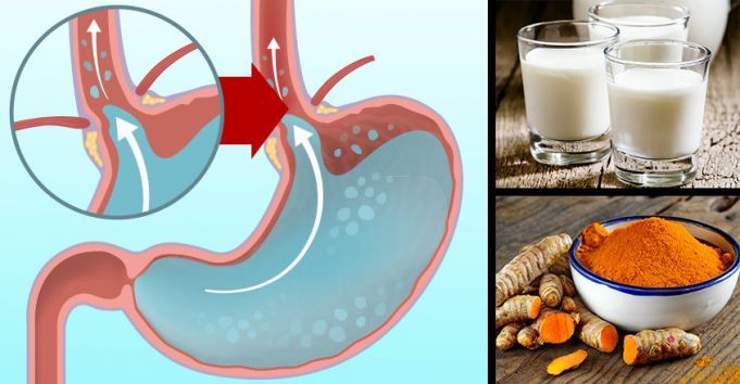 These 6 Daily Hacks Could Cure Acid Reflux For Good