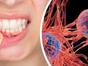 Got Gingivitis? Get Checked For This Deadly Disease