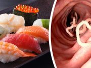 After Eating Sushi, You’ll Never Believe What Was Living In This Man’s Body