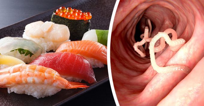 After Eating Sushi, You’ll Never Believe What Was Living In This Man’s Body