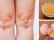 How To Use ACV And Egg Yolks For Knee Pain