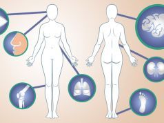 Ladies: 15 Early Warning Signs Of Lupus You Shouldn’t Ignore