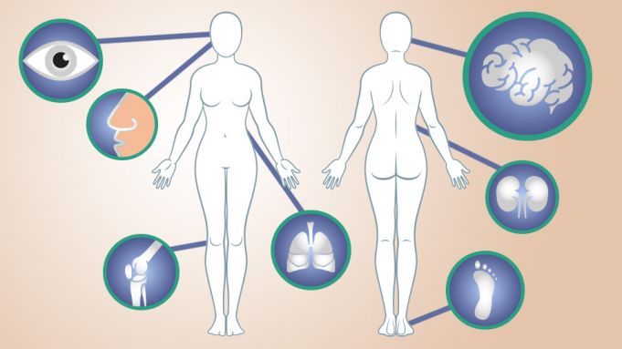 Ladies: 15 Early Warning Signs Of Lupus You Shouldn’t Ignore