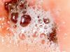 Clean Mold and Wounds with This Must-Have Solution (hint: it’s super cheap)