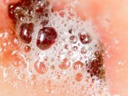 Clean Mold and Wounds with This Must-Have Solution (hint: it’s super cheap)