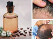 Fight Baldness + 2 Other Reasons To Use Castor Oil On Your Hair