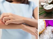 I’ve Suffered From Eczema My Whole Life. Here Are 5 Natural Remedies That Help
