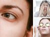 Sliced Potatoes + 4 Other Natural Remedies For Dark Circles Under Your Eyes