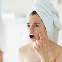 Zap pimples with apple cider vinegar