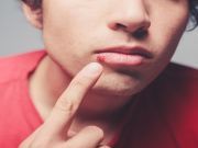 6 Ways to Naturally Banish that Blister on Your Lip