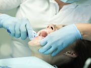 What You Might Not Know about That Root Canal